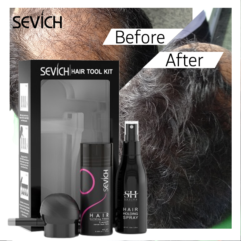 Keratin Treatment Set - مجموعة ألياف الشعر السوداء، ألياف لنمو