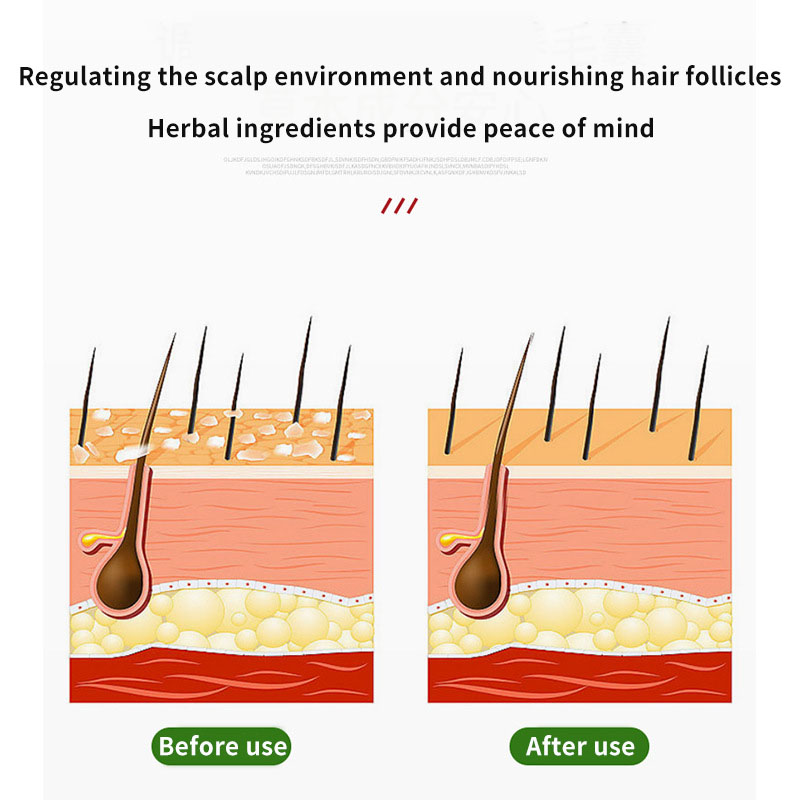 كريم بصيلات الشعر من Sophora F - مراجعة Hair Care Cream وسعره