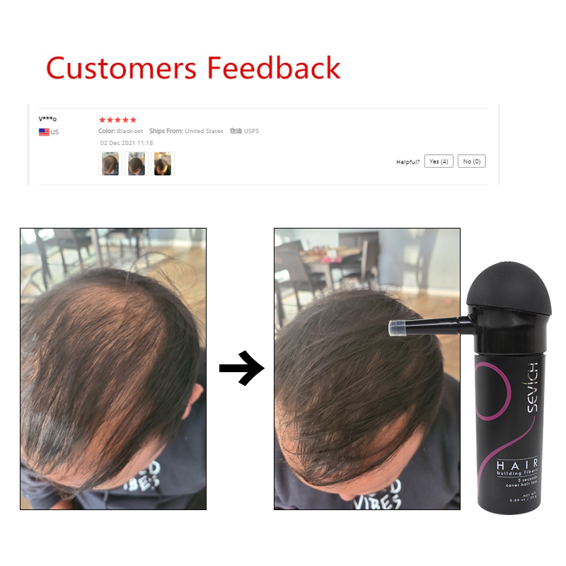 Sevich 2 قطعة/الوحدة 10 ألوان  - مراجعة Keratin Treatment Set وسعره
