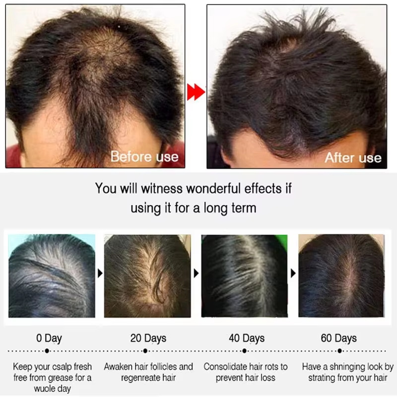 بخاخ الزنجبيل السريع لنمو الشع - مراجعة Hair Care Nutrition وسعره